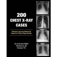  200 Chest X-Ray Cases – Mudher Al-Khairalla,James Chalmers,Tom Fardon idegen nyelvű könyv