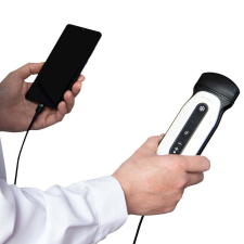  CHISON SONOEYE P5 colour + PW orvosi diagnosztikus ultrahang gyógyászati segédeszköz