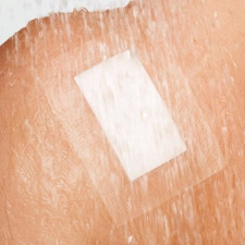  CURAPOR TRANSPARENT vízálló szigetkötszer 10x15cm gyógyászati segédeszköz