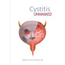  Cystitis Unmasked – JAMES MALONE-LEE MD idegen nyelvű könyv