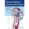  Decision Making in Neurovascular Disease – Leonardo Rangel-Castilla,Peter Nakaji,Adnan Hussain Siddiqui,Robert F. Spetzler,Elad I Levy