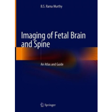 Imaging of Fetal Brain and Spine – B. S. Rama Murthy idegen nyelvű könyv