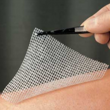 LOMATUELL kenőcstüll 5x5 cm gyógyászati segédeszköz