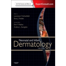 Neonatal and Infant Dermatology – Lawrence Eichenfield idegen nyelvű könyv