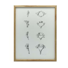 NYAKI csigolyák ANATÓMIAI PLAKÁT ANATÓMIÁJA KERETBEN 30x40 CM grafika, keretezett kép
