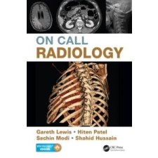 On Call Radiology – Shahid Hussain idegen nyelvű könyv