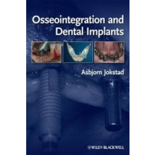  Osseointegration and Dental Implants – Asbjorn Jokstad idegen nyelvű könyv