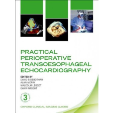 Practical Perioperative Transoesophageal Echocardiography – David Sidebotham idegen nyelvű könyv