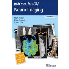  RadCases Plus Q&A Neuro Imaging – Roy Riascos,Eliana Bonfante,Susana Calle idegen nyelvű könyv