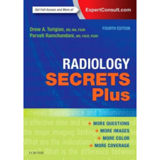  Radiology Secrets Plus – Drew A. Torigian,Ramchandani,Parvati,M.D. idegen nyelvű könyv