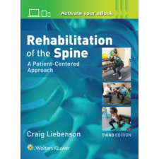 Rehabilitation of the Spine: A Patient-Centered Approach – Brian Brown (Könyv) idegen nyelvű könyv