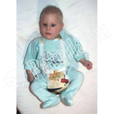 Ricsi Ricsi Terpeszpelenka 50Cm 3Kg Hevederes gyógyászati segédeszköz