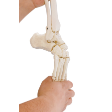  Rugalmas lábfej csontváz sípcsont- és szárkapocscsont-csonkkal gyógyászati segédeszköz
