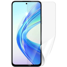 SCREENSHIELD HUAWEI Honor X7b védőfólia mobiltelefon kellék