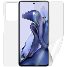 SCREENSHIELD XIAOMI 11T kijelzővédő fólia (XIA-11T-B) mobiltelefon kellék