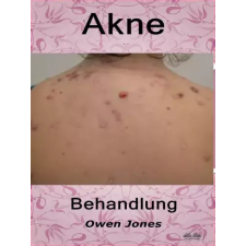 Tektime Akne-Behandlung egyéb e-könyv
