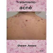 Tektime Tratamiento Del Acné egyéb e-könyv