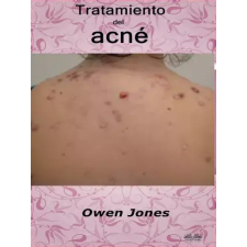 Tektime Tratamiento Del Acné egyéb e-könyv