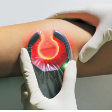  TransLite Veinlite LED+ vénakereső LED 28LED gyógyászati segédeszköz