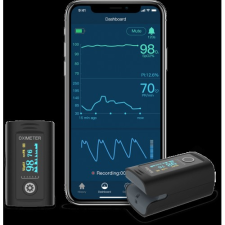 Viatom Oxismart Bluetooth pulzoximéter véroxigénszint mérő