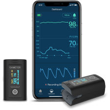 Viatom Oxismart Bluetooth pulzoximéter véroxigénszint mérő