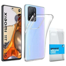 xPRO Xiaomi 11T/11T Pro Átlátszó Szilikon Tok tok és táska